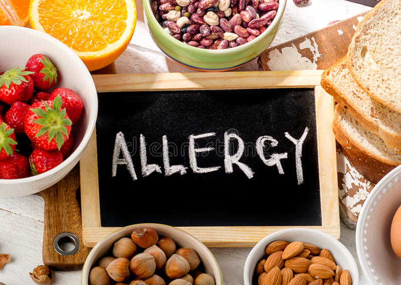 Managing Food Allergies and Ezcema in children.