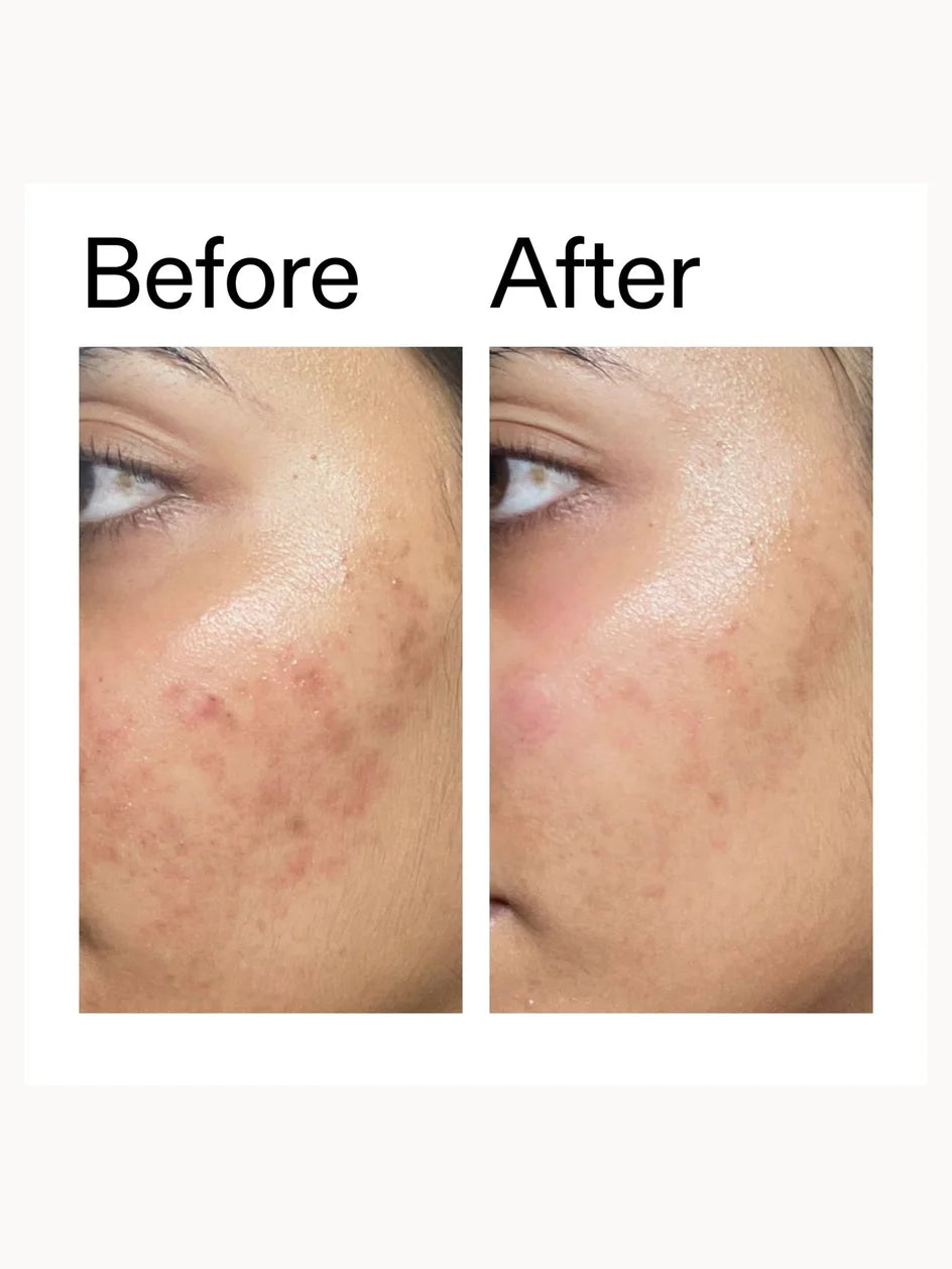 The Inkey List Ectoin Hydro Barrier Serum 30ml