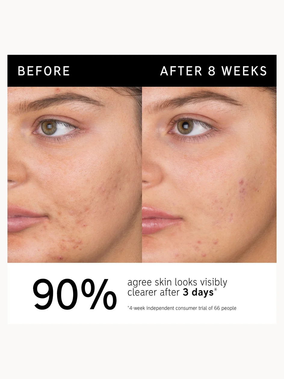 The Inkey List Salicylic Acid