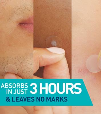 Cerave Blemish Barrier Patch